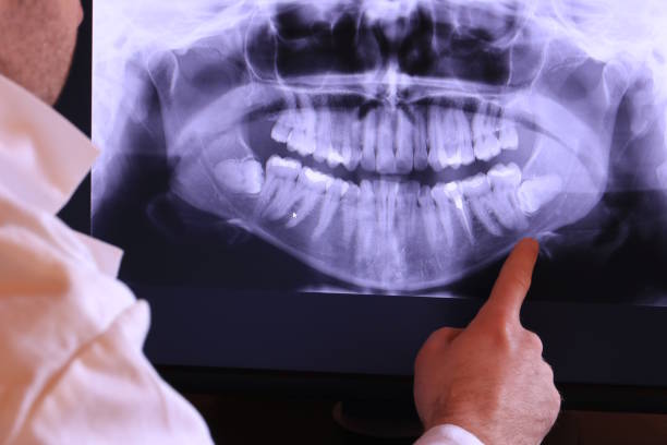 Best Broken Tooth Emergency  in Lynn Haven, FL