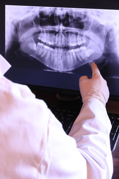 Best Chipped Tooth Repair Near Me  in Lynn Haven, FL