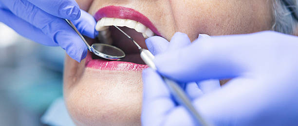 Best Knocked-Out Tooth Emergency  in Lynn Haven, FL